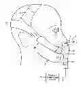 Fig. 01 - PATIENT INTERFACE DEVICE HAVING A FABRIC POUCH FOR A CUSHION