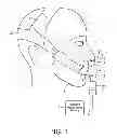 Fig. 02 - PATIENT INTERFACE DEVICE HAVING A FABRIC POUCH FOR A CUSHION