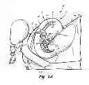Fig. 02 - Engine wash apparatus and method