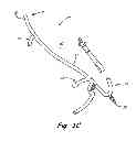 Fig. 04 - Engine wash apparatus and method