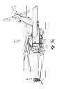 Fig. 08 - Engine wash apparatus and method