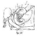 Fig. 02 - Engine wash apparatus and method