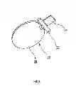 Fig. 06 - Foamable filling device