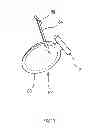 Fig. 14 - Foamable filling device