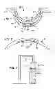 Fig. 02 - Variable focus electroactive ophthalmic device