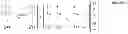 Fig. 08 - Methods for estimation and interference suppression for signal processing
