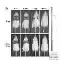 Fig. 01 - Polyethyleneimine And Beta2-Adrenergic Receptor Based Gene Therapy For Acute Lung Injury