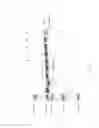 Fig. 43 - COMPOSITIONS AND METHODS FOR TREATING COLLAGEN-MEDIATED DISEASES
