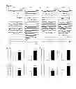 Fig. 02 - Methods for treating and/or limiting development of diabetes