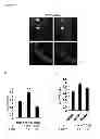 Fig. 19 - Methods for Modulation of Autophagy Through the Modulation of Autophagy-Enhancing Gene Products