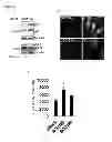 Fig. 68 - Methods for Modulation of Autophagy Through the Modulation of Autophagy-Enhancing Gene Products
