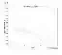 Fig. 11 - Treatment method for relapsing-remitting multiple sclerosis