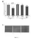 Fig. 06 - Methods and compositions for inhibiting diseases of the central nervous system