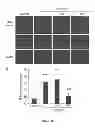 Fig. 109 - Methods and compositions for inhibiting diseases of the central nervous system