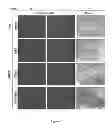Fig. 12 - Methods and compositions for inhibiting diseases of the central nervous system