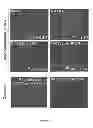 Fig. 17 - Methods and compositions for inhibiting diseases of the central nervous system