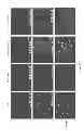 Fig. 44 - Methods and compositions for inhibiting diseases of the central nervous system