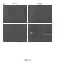 Fig. 65 - Methods and compositions for inhibiting diseases of the central nervous system