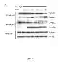 Fig. 87 - Methods and compositions for inhibiting diseases of the central nervous system