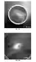 Fig. 03 - NANOFIBER SCAFFOLDS AND METHODS FOR REPAIRING SKIN DAMAGE