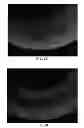 Fig. 07 - NANOFIBER SCAFFOLDS AND METHODS FOR REPAIRING SKIN DAMAGE