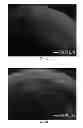 Fig. 08 - NANOFIBER SCAFFOLDS AND METHODS FOR REPAIRING SKIN DAMAGE