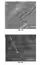 Fig. 14 - NANOFIBER SCAFFOLDS AND METHODS FOR REPAIRING SKIN DAMAGE
