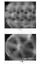Fig. 15 - NANOFIBER SCAFFOLDS AND METHODS FOR REPAIRING SKIN DAMAGE