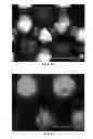 Fig. 18 - NANOFIBER SCAFFOLDS AND METHODS FOR REPAIRING SKIN DAMAGE