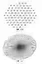 Fig. 23 - NANOFIBER SCAFFOLDS AND METHODS FOR REPAIRING SKIN DAMAGE