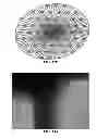 Fig. 24 - NANOFIBER SCAFFOLDS AND METHODS FOR REPAIRING SKIN DAMAGE