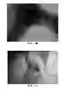 Fig. 25 - NANOFIBER SCAFFOLDS AND METHODS FOR REPAIRING SKIN DAMAGE