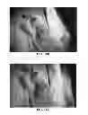 Fig. 26 - NANOFIBER SCAFFOLDS AND METHODS FOR REPAIRING SKIN DAMAGE