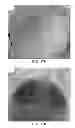 Fig. 30 - NANOFIBER SCAFFOLDS AND METHODS FOR REPAIRING SKIN DAMAGE