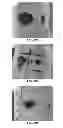 Fig. 35 - NANOFIBER SCAFFOLDS AND METHODS FOR REPAIRING SKIN DAMAGE