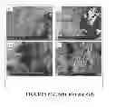 Fig. 07 - Bone substitute compositions, methods of preparation and clinical applications