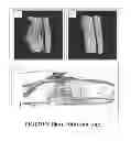 Fig. 11 - Bone substitute compositions, methods of preparation and clinical applications
