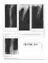 Fig. 13 - Bone substitute compositions, methods of preparation and clinical applications