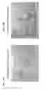 Fig. 22 - BIOCOMPATIBLE POLYACRYLATE COMPOSITIONS AND METHODS OF USE