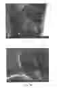 Fig. 07 - Methods of treatment of polymeric coatings for control of agent release rates
