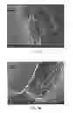 Fig. 09 - Methods of treatment of polymeric coatings for control of agent release rates