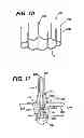 Fig. 08 - THERAPEUTIC AGENT ELUTION CONTROL PROCESS