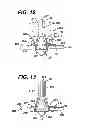 Fig. 09 - THERAPEUTIC AGENT ELUTION CONTROL PROCESS