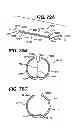 Fig. 50 - THERAPEUTIC AGENT ELUTION CONTROL PROCESS