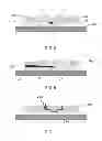 Fig. 03 - Microfluidic surface processing device and method