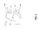 Fig. 04 - COMPONENTS WITH MATING SURFACES