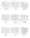 Fig. 22 - TEXTILE MATERIALS COMPRISING TAPES IN TWO OBLIQUE ORIENTATIONS AND ITS METHOD AND MEANS FOR PRODUCTION