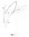 Fig. 03 - Dental appliance