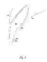 Fig. 04 - Dental appliance