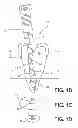 Fig. 03 - ENDODONTIC INSTRUMENT FOR DRILLING THE ROOT CANALS OF A TOOTH